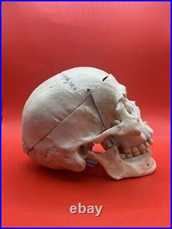 Antique Medical Skull From a German Museum Oddities Anatomical Real