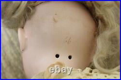 RARE Antique 25 GERMAN Bisque Head Comp Joint Body Doll